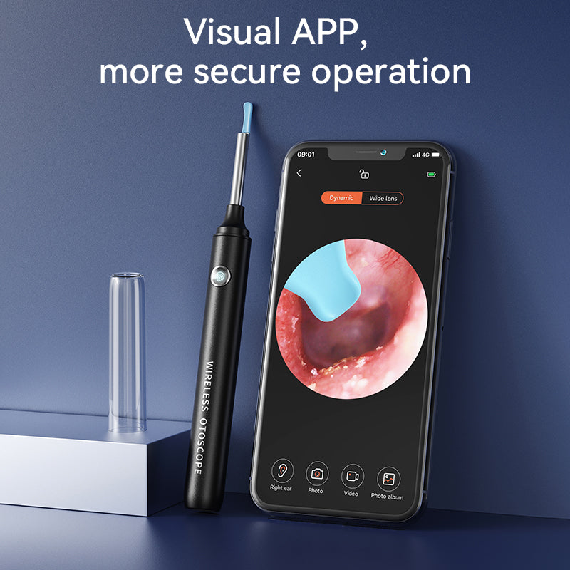 Pro-Grade Ear Cleaner with 1080P Camera ✨ Real-Time Ear Wax Removal for iPhone/Android 💡 Surgery-Level Visibility + Kid-Safe Scoop 🌟 #EarHack #OddlySatisfying Pro-Grade Ear Cleaner with 1080P Camera ✨ Real-Time Ear Wax Removal for iPhone/Android 💡 Surgery-Level Visibility + Kid-Safe Scoop 🌟 #EarHack #OddlySatisfying